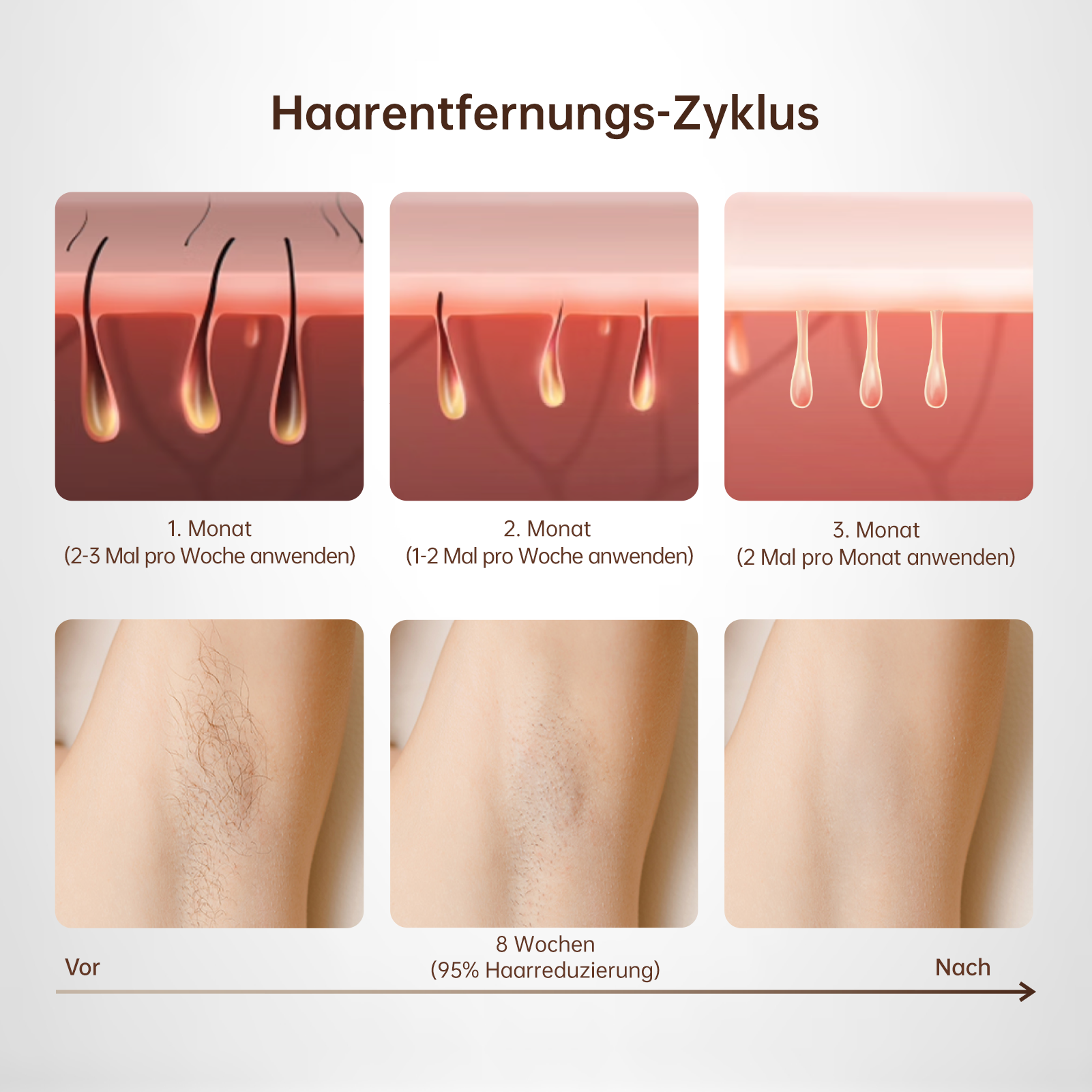 3 in 1 IPL Geräte Haarentfernung Laser, 600NM Effizient Laser Haarentfernung 9 Energiestufen 999.900 Lichtimpulse Hause Epilierer für Männer und Frauen